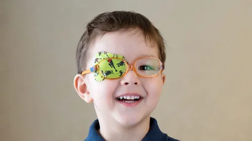 Amblyopia