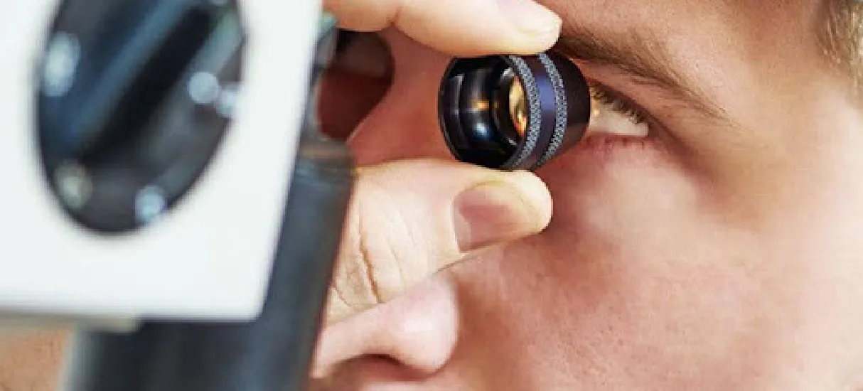 Glaucoma