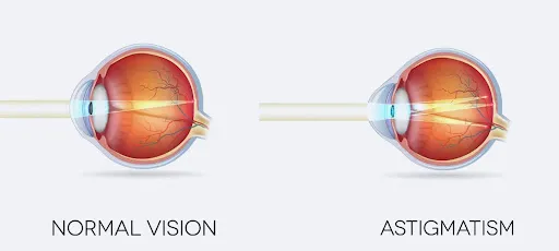 Refraction
