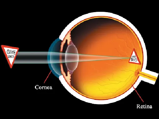 Visual System