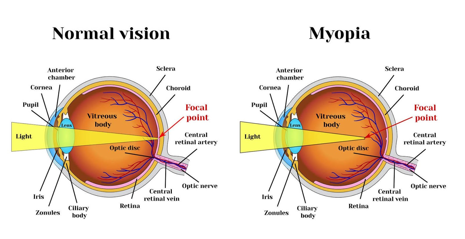 Eyeball Anatomy